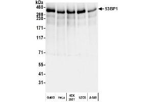 Western Blotting (WB) image for anti-Tumor Protein P53 Binding Protein 1 (TP53BP1) (AA 350-400) antibody (ABIN7453568) (TP53BP1 anticorps  (AA 350-400))