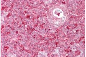 Anti-TIMELESS antibody IHC staining of human thymus.