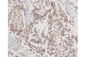 IHC analysis of EGFR using anti-EGFR antibody (ABIN5518909). (EGFR anticorps  (N-Term))