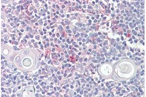 Anti-LITAF antibody IHC staining of human thymus. (LITAF anticorps  (AA 51-64))