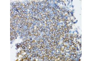 Immunohistochemistry of paraffin-embedded Rat spleen using UBE2D1 Polyclonal Antibody at dilution of 1:100 (40x lens).