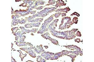 IHC analysis of ALDH1A1 using anti-ALDH1A1 antibody (ABIN7602127). (ALDH1A1 anticorps  (AA 6-342))