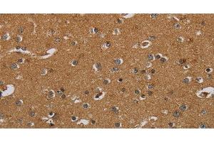 Immunohistochemistry of paraffin-embedded Human brain using HSD17B2 Polyclonal Antibody at dilution of 1:50