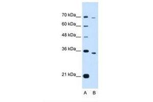 Image no. 1 for anti-PHD Finger Protein 6 (PHF6) (AA 152-201) antibody (ABIN321840) (PHF6 anticorps  (AA 152-201))