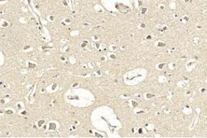 Immunohistochemical analysis of paraffin-embedded Human brain section using Pink1 F.