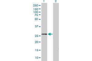Western Blot analysis of DDAH2 expression in transfected 293T cell line by DDAH2 MaxPab polyclonal antibody. (DDAH2 anticorps  (AA 1-285))