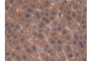 Detection of IL22Ra2 in Rat Liver Tissue using Polyclonal Antibody to Interleukin 22 Receptor Alpha 2 (IL22Ra2)