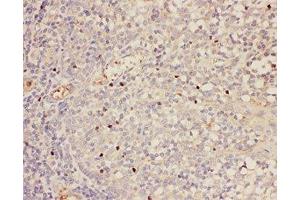 IHC-P: FOXP3 antibody testing of human tonsil tissue (FOXP3 anticorps  (AA 101-431))