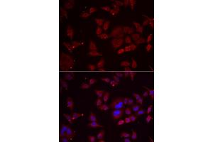 Immunofluorescence analysis of U2OS cells using PFKFB3 antibody (ABIN5974173). (PFKFB3 anticorps)