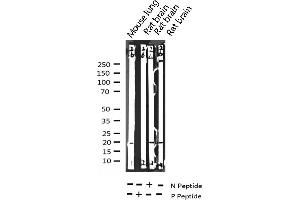 Western blot analysis of Phospho-Stathmin 1 (Ser24) expression in various lysates