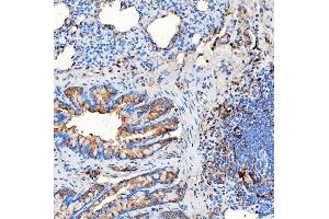 IHC analysis of RAB7/RAB7A using anti-RAB7/RAB7A antibody (ABIN7600597). (RAB7A anticorps  (AA 21-177))