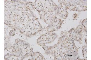 Immunoperoxidase of monoclonal antibody to PPP1R2 on formalin-fixed paraffin-embedded human placenta.