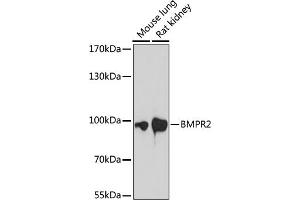 Western blot analysis of extracts of various cell lines, using BMPR2 antibody (ABIN7265906) at 1:1000 dilution.