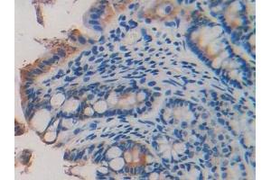 Detection of LAMb2 in Mouse Small intestine Tissue using Polyclonal Antibody to Laminin Beta 2 (LAMb2)