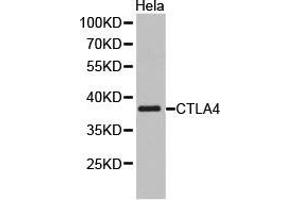 Western Blotting (WB) image for anti-Cytotoxic T-Lymphocyte-Associated Protein 4 (CTLA4) antibody (ABIN1872073) (CTLA4 anticorps)
