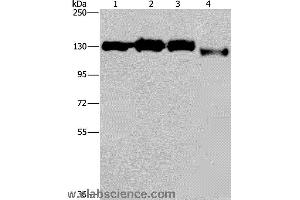 Western blot analysis of Hela, 293T, Raji and 231 cell, using GTF2I Polyclonal Antibody at dilution of 1:400 (GTF2I anticorps)
