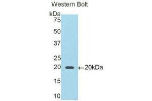 Western Blotting (WB) image for anti-Interleukin 6 Receptor (IL6R) (AA 216-356) antibody (ABIN1175051)