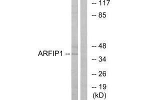 Western blot analysis of extracts from Jurkat cells, using ARFIP1 antibody. (ARFIP1 anticorps)