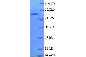 SDS-PAGE (SDS) image for Zinc Finger Protein 384 (ZNF384) (AA 1-245), (partial) protein (GST tag) (ABIN5712293) (ZNF384 Protein (AA 1-245, partial) (GST tag))