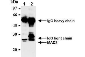 Western Blotting (WB) image for anti-MAD2 Mitotic Arrest Deficient-Like 1 (Yeast) (MAD2L1) antibody (ABIN567786)