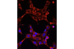 Immunofluorescence analysis of NIH/3T3 cells using IR antibody (ABIN6130497, ABIN6142514, ABIN6142515 and ABIN6216327) at dilution of 1:100.