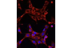 Immunofluorescence analysis of NIH/3T3 cells using IR antibody (ABIN6130497, ABIN6142514, ABIN6142515 and ABIN6216327) at dilution of 1:100. (IRAK1 anticorps  (AA 424-633))