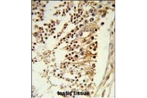 Formalin-fixed and paraffin-embedded human testis tissue reacted with CENPH Antibody (Center), which was peroxidase-conjugated to the secondary antibody, followed by DAB staining.