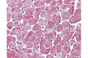 Anti-AKT antibody IHC of human heart. (AKT1/2 anticorps)