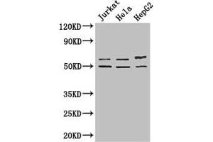 Western Blot Positive WB detected in: Jurkat whole cell lysate, Hela whole cell lysate, HepG2 whole cell lysate All lanes: YTHDF2 antibody at 2. (YTHDF2 anticorps  (AA 201-500))