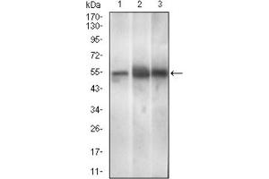 Western blot analysis using PAX3 antibody against Mouse brain (1), Rat spleen (2), Mouse liver (3) cell lysate. (Paired Box 3 anticorps  (AA 142-203))