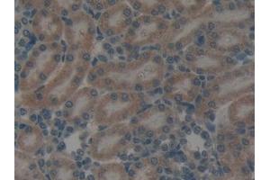 Detection of GATA4 in Rat Kidney Tissue using Polyclonal Antibody to GATA Binding Protein 4 (GATA4)