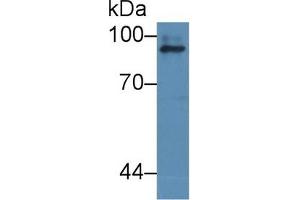 Detection of ICAM1 in Human dog liver cell lysate using Polyclonal Antibody to Intercellular Adhesion Molecule 1 (ICAM1) (ICAM1 anticorps  (AA 25-531))