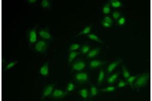 Immunofluorescence analysis of U2OS cells using SSRP1 Polyclonal Antibody (SSRP1 anticorps)