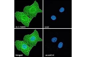 (ABIN184675) Immunofluorescence analysis of paraformaldehyde fixed U2OS cells, permeabilized with 0.