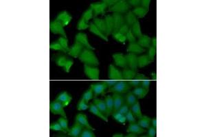 Immunofluorescence analysis of MCF7 cells using HBA1 Polyclonal Antibody (HBA1 anticorps)