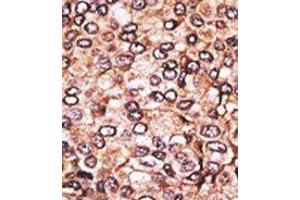 Image no. 2 for anti-MAGE-Like 2 (MAGEL2) (N-Term) antibody (ABIN358645) (MAGE-Like 2 anticorps  (N-Term))