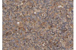 ABIN6266864 at 1/100 staining human lymph node tissue sections by IHC-P.