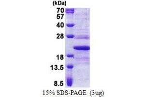 SDS-PAGE (SDS) image for Transmembrane Emp24-Like Trafficking Protein 10 (TMED10) (AA 32-185) protein (His tag) (ABIN6387259)