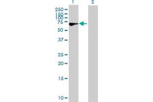 Western Blot analysis of CACNB3 expression in transfected 293T cell line by CACNB3 MaxPab polyclonal antibody. (CACNB3 anticorps  (AA 1-484))