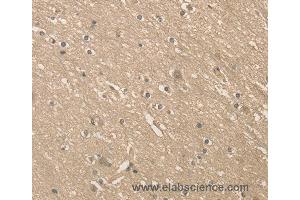 Immunohistochemistry of Human brain  using ALDH8A1 Polyclonal Antibody at dilution of 1:40 (ALDH8A1 anticorps)