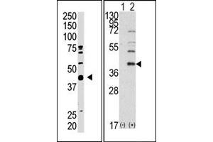 Image no. 2 for anti-SUMO1 Activating Enzyme Subunit 1 (SAE1) (C-Term) antibody (ABIN357744) (SAE1 anticorps  (C-Term))