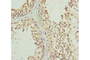 Immunohistochemistry of paraffin-embedded human testis tissue using ABIN7163477 at dilution of 1:100 (PIWIL1 anticorps  (AA 390-690))