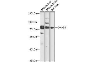 Western blot analysis of extracts of various cell lines, using DHX58 antibody (ABIN6129372, ABIN6139609, ABIN6139610 and ABIN6224272) at 1:1000 dilution. (DHX58 anticorps  (AA 389-678))