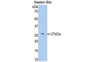 Western blot analysis of recombinant Human IFNa/bR1. (IFNAR1 anticorps  (AA 28-227))
