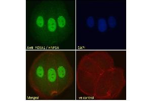 ABIN185021 Immunofluorescence analysis of paraformaldehyde fixed MCF7 cells, permeabilized with 0. (FOXA1 anticorps  (C-Term))