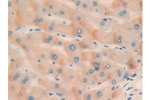 Detection of CCND2 in Human Liver Tissue using Polyclonal Antibody to Cyclin D2 (CCND2)