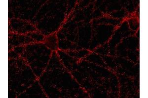 Indirect immunostaining of rat hippocampus neurons (dilution 1 : 500).