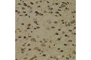 Immunohistochemistry (IHC) image for anti-8-Oxoguanine DNA Glycosylase (OGG1) (AA 1-345) antibody (ABIN3021937) (OGG1 anticorps  (AA 1-345))