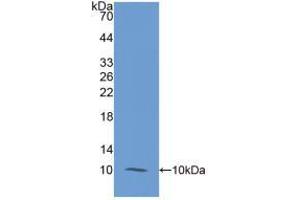 Western blot analysis of recombinant Human S100A12.