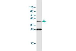 Western Blot detection against Immunogen (36. (SSH1 anticorps  (AA 950-1049))